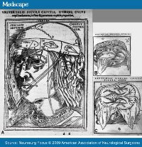 Johann Dryander, one of the first German doctors to perform public disections, published his 'Anatomia Capitis Humani' in 1536, which contained the most extensive study on the human head to date, and the first 'Galenic dissection' of the brain. (View Larger)