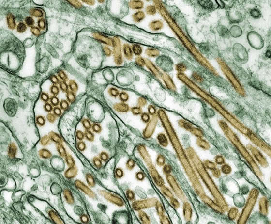 Colorized transmission electron micrograph of Avian influenza A H5N1 viruses (seen in gold) grown in MDCK cells (seen in green)