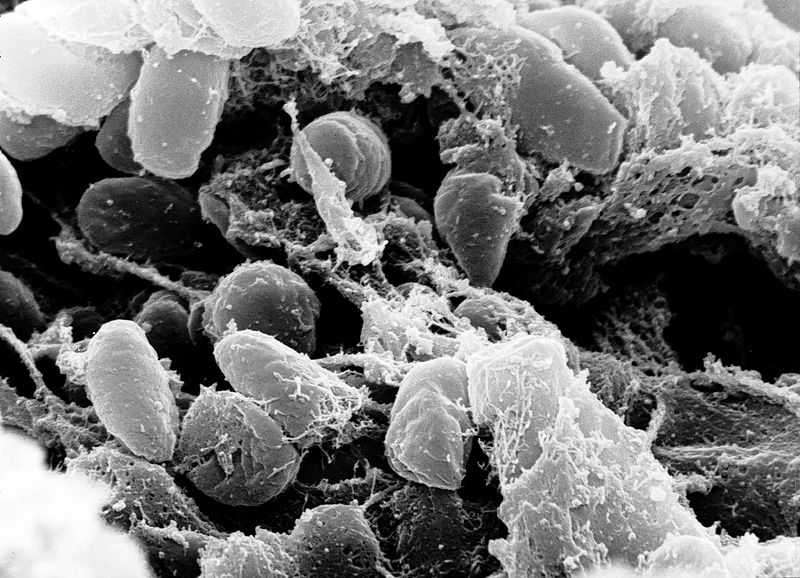 A scanning electron micrograph depicting a mass of Yersinia pestis bacteria, which is the cause of the Bubonic Plague.