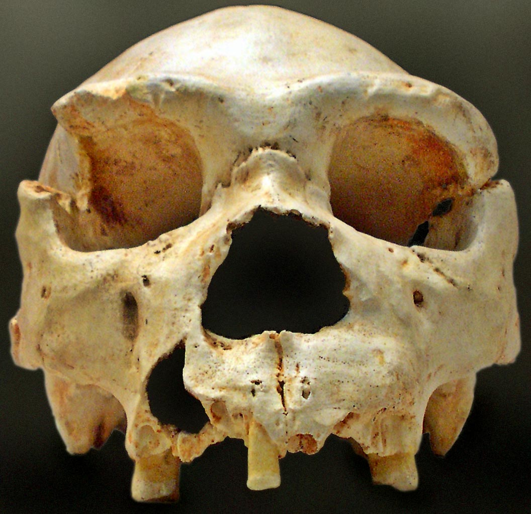 The "Homo Heidelbergensis Cranium 5" from Sima de los Huesos in Spain.