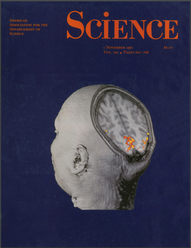 The November 1, 1991 issue of Science contained the paper "Functional mapping of the human visual cortex by magnetic resonance imaging," by Dr. John Belliveau and colleagues. On the cover is 